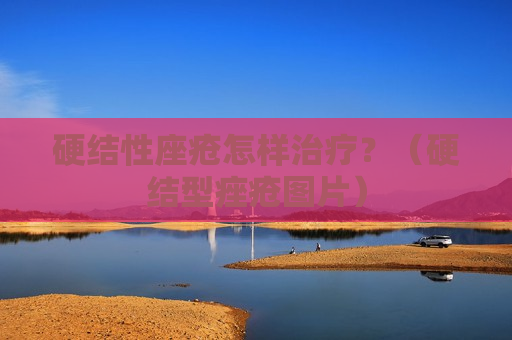 硬结性座疮怎样治疗？（硬结型痤疮图片）